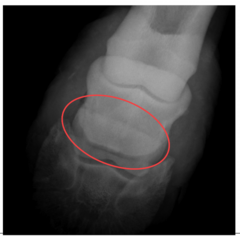 <p>what angle is this where the NB is superimpsoed on P2</p>