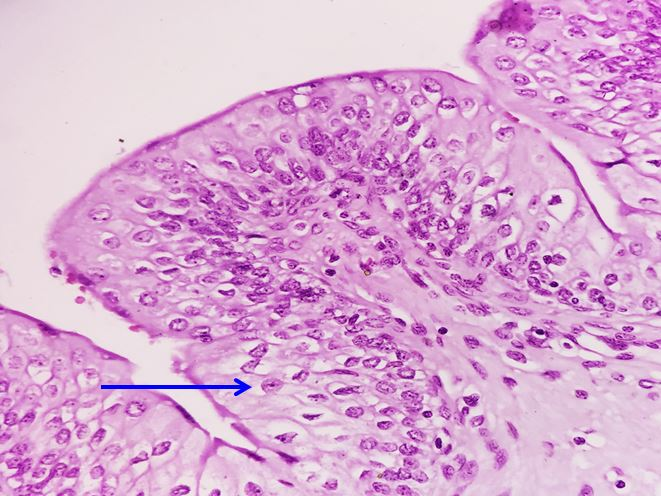 <p>Biểu mô gì ?</p>