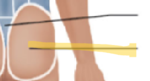 <p>What term is this? </p>