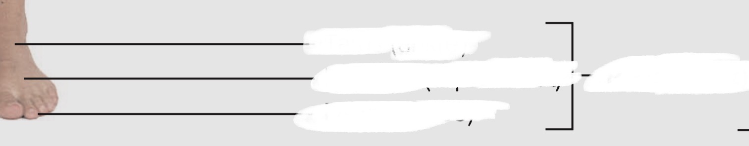 <p>Foot</p>