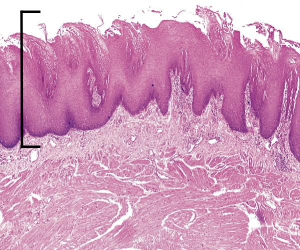<p>What is this top layer?</p>