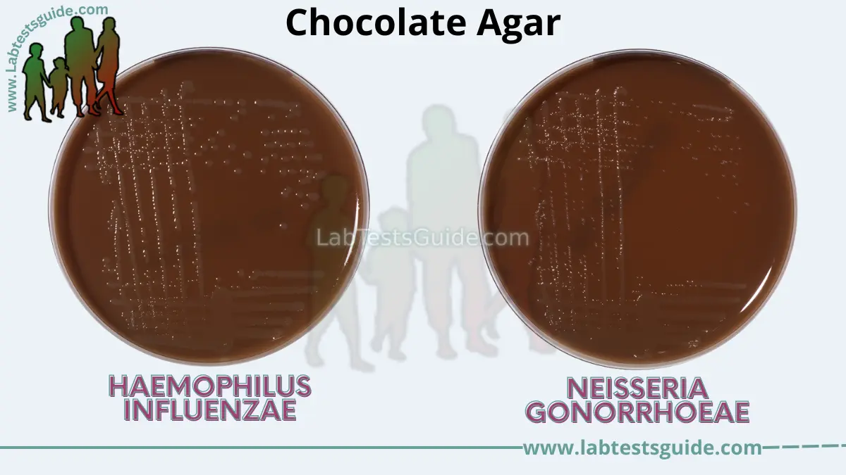 <p>Chocolate Agar - What does it contain?</p>