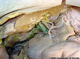 <p>what artery is being indicated to in the image?</p>
