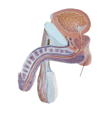 <p><span>Name the structure</span></p>