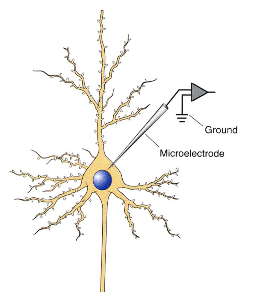 <p>Microelectrode recording technique</p>