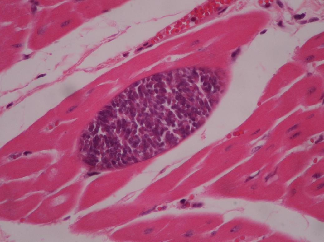 <p>SARCOCYSTIS</p>