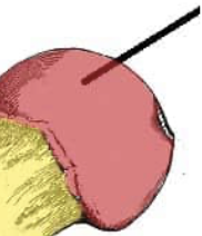 <p>A large, rounded end of a bone that helps form a joint</p><p>The _____ of the femur is the ball-like upper end of the thigh bone that fits into the hip socket</p>