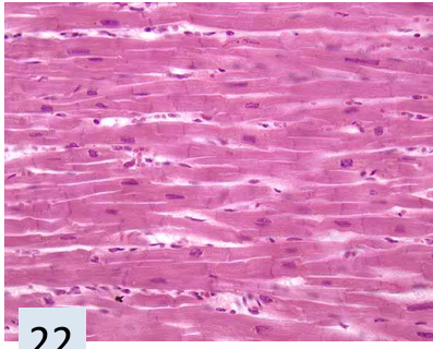 <p>what tissue is this? </p>