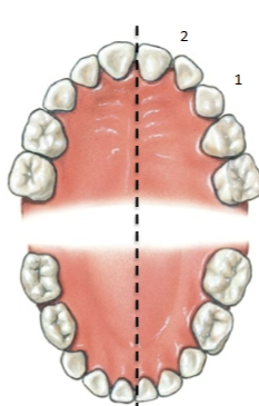 <p>20 total, No premolars, only 2 molars. Begin eruption between 6-24 months and shed 6-12 years old</p>