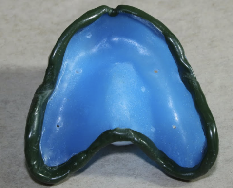 <p>What impression material should you use for the border molding</p>