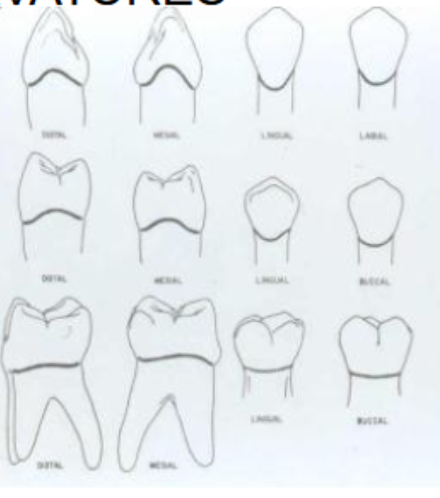 <ol><li><p>curved to incisal/occlusal on m/d</p></li><li><p>curved toward apical on facial/lingual</p></li><li><p>depth of curveture is greater on mesial than distal</p></li><li><p>cervical lines on approximatig surfaces of adjacent teeth are the same</p></li><li><p>depth greatest on incisors(mesial of centrals) and decrease as move postieriorly</p></li></ol><p></p>