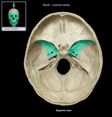 <p>a part of the sphenoid bone</p>