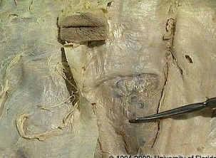 <p>what is the name of the fascia that is inferior to the arcuate line (as pictured here)?</p>