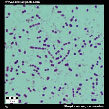 <p>gram + diplococci (sometimes aligned in chains) </p>