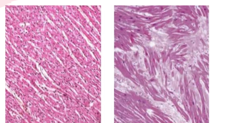 <p>What is being compared on the histology slide? explain what histology is? - its how the what are structure? how HCM is orgainzed in the myocardium and list two things it can affect?</p>