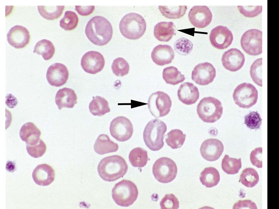 <p><span>The arrow in the center of the image below is pointing to&nbsp;</span></p>