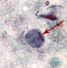 <p>Up to 4 nuclei </p><p>15-20 microns</p><p>Small central karosome and fine peripheral chromatin</p>