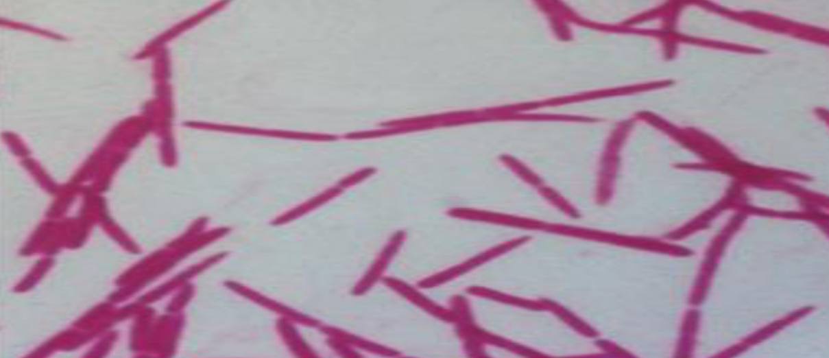 <p>Specimen (microscopically slide):</p><p>• Name of organism:</p><p>• Stain:</p><p>• Sample from: culture or pus or in tissue</p><p>• Morphology</p>