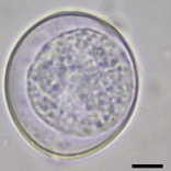 <p><span>Dogs &amp; Cats, Pigs (C. suis), Humans (C. belli), Nonhuman primates (C. arctopitheci,C. callimico, and C. scorzai). &nbsp;</span></p><p style="text-align: left;"><span>Most species oocysts measuring ~ 20-53 X 10-43 µm (animal ones being larger than C. belli).</span></p>