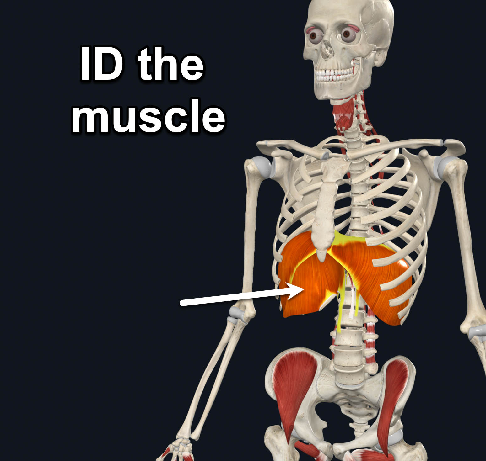 term image