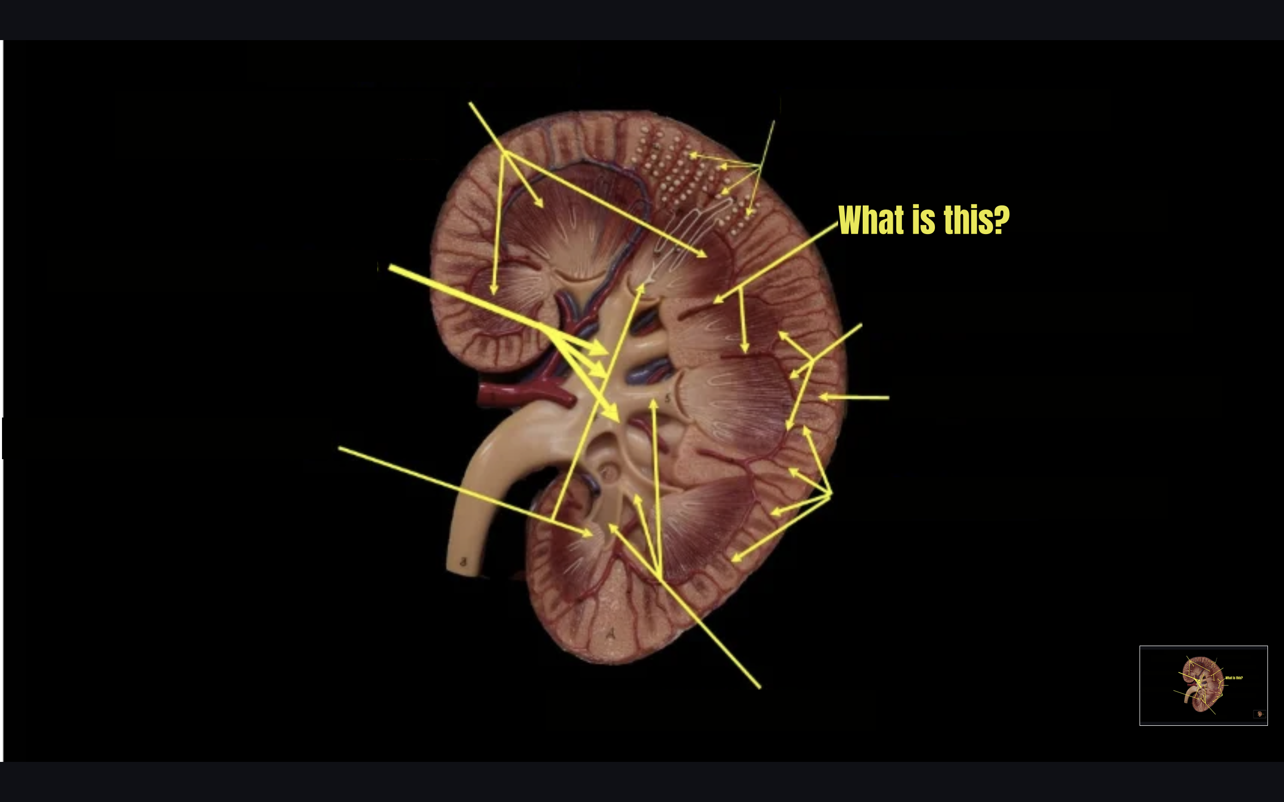 term image