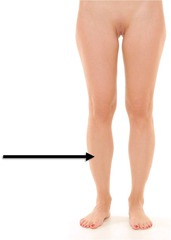 <p>Leg</p>