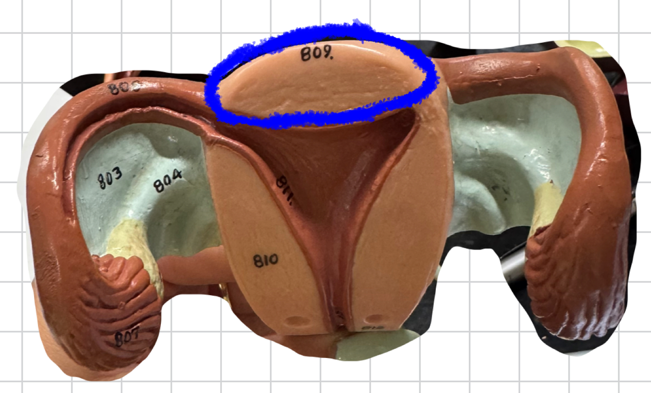 term image
