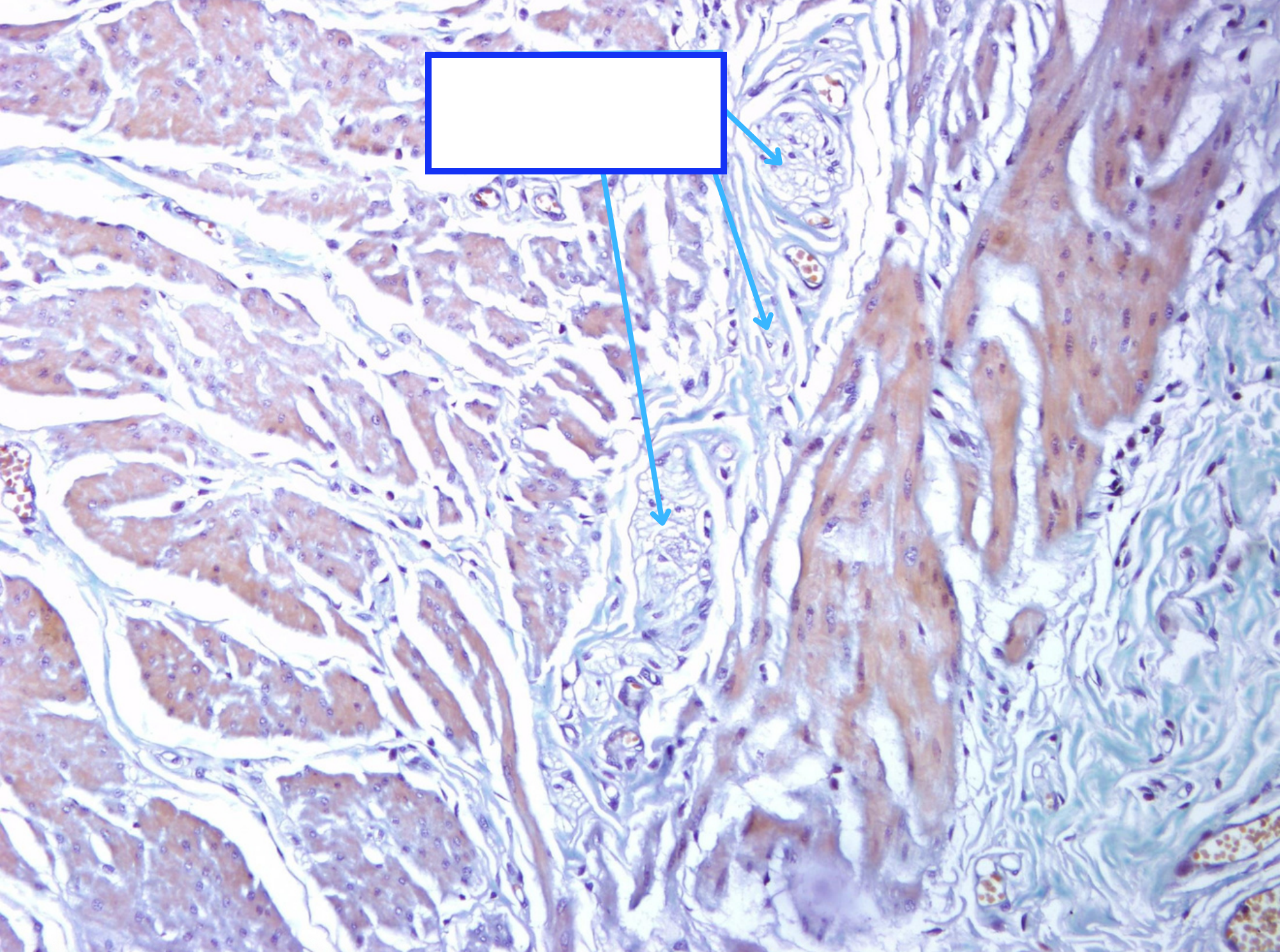 <p>Cấu trúc gì ?</p>