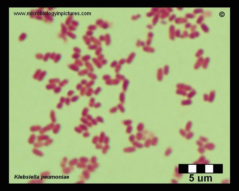 <ul><li><p>Gram: Negative</p></li><li><p>Capsule: Positive</p></li><li><p>Endospore: Negative</p></li><li><p>Acid-fast: Negative</p></li></ul><p>Rods in single/pair</p><p></p>