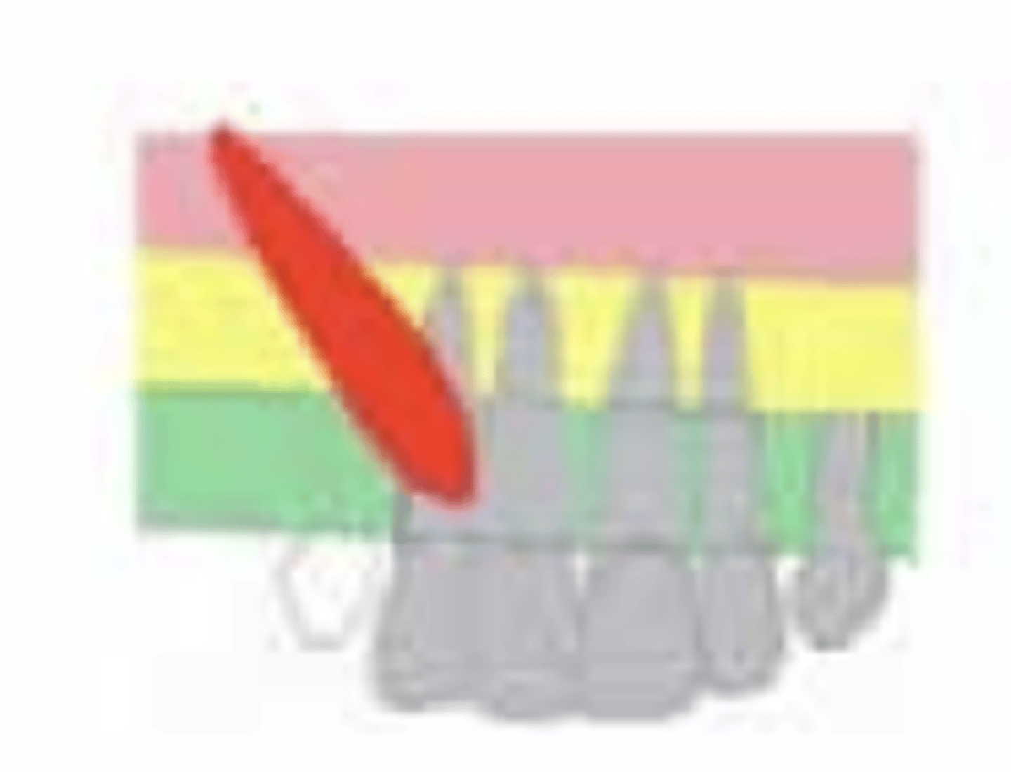 <p>What is the prognosis?</p><p>- Vertical Height: CEJ - halfway up root</p>