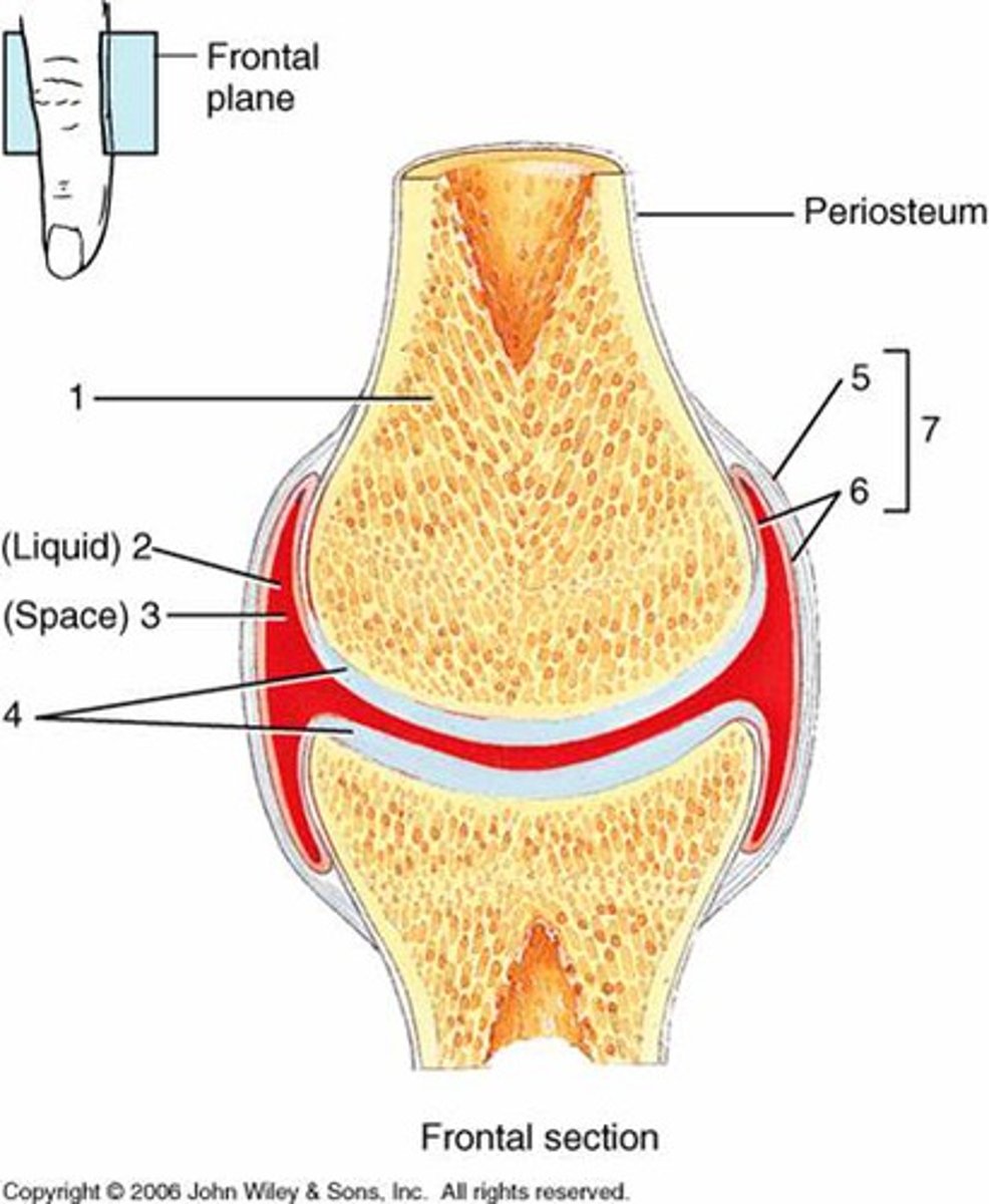 <p>fluid filled cavity present, most common</p>