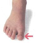 <p>toe</p>
