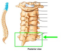 <p>- has a long prominent spinous process</p>