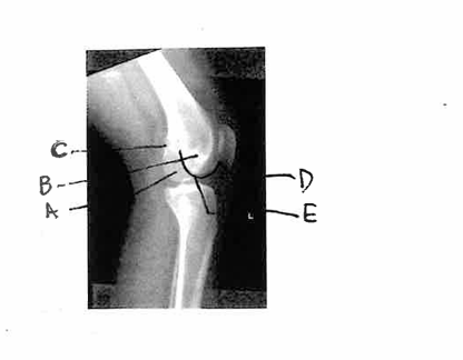 <p><span style="background-color: transparent;">Which of the labeled structures is the adductor tubercle?</span></p>