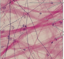 <p>what tissue type?</p>