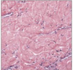 <p>Classify this connective tissue</p>