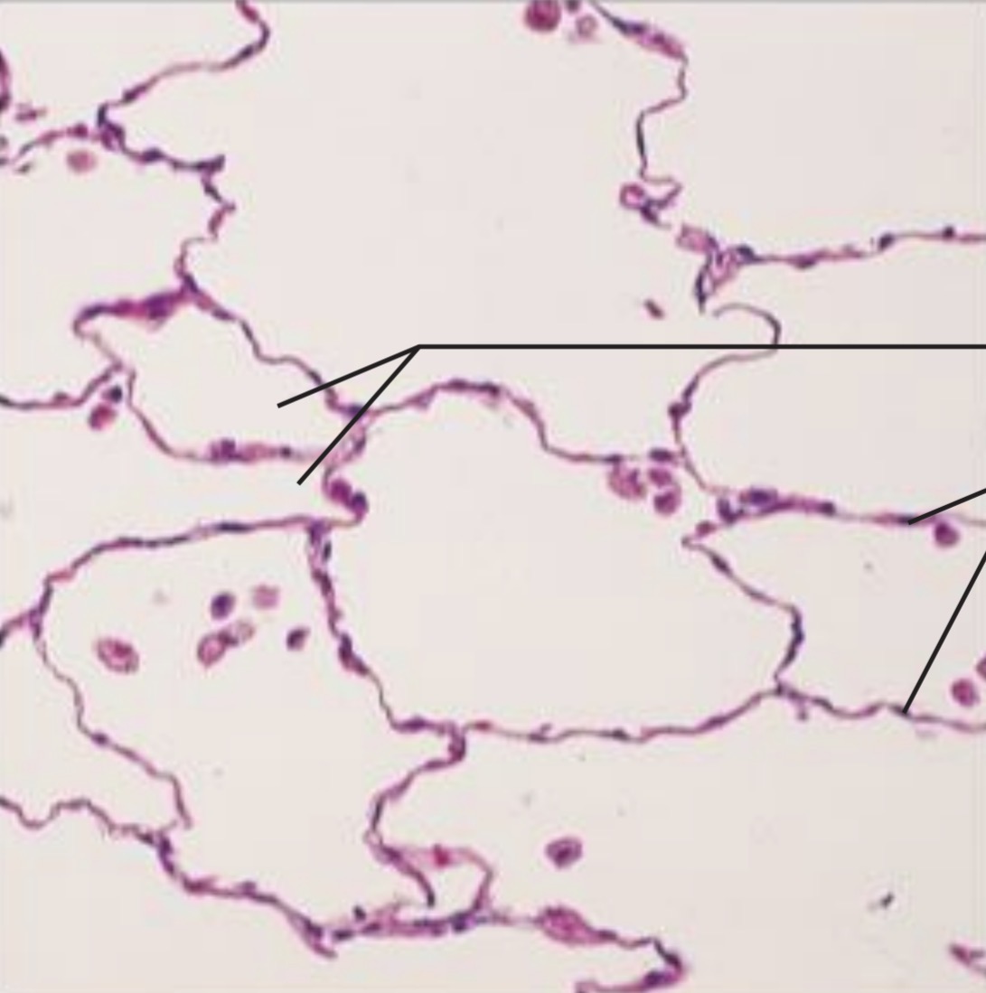 <p><span>Diffusion and filtration.</span></p>