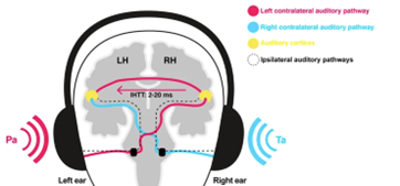 <p>involves the simultaneous presentation of two different acoustic signals to the right and left ears</p><ul><li><p>participants better at reporting stimuli presented to the right ear if more left hemisphere dominant (Kimura, 1967; 2011)</p></li></ul><p>because when both ears are simultaneously stimulated, uncrossed pathways are suppressed</p><ul><li><p>right ear input directly reaches LH</p></li><li><p>but left ear input travels via RH</p></li></ul><p></p>