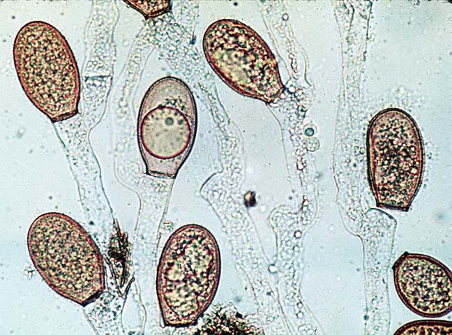 <ul><li><p>occur in water and soil</p></li><li><p>primitive….no partitions</p></li><li><p>can produce flagellated cells</p></li><li><p>oogametes</p></li></ul><p></p>