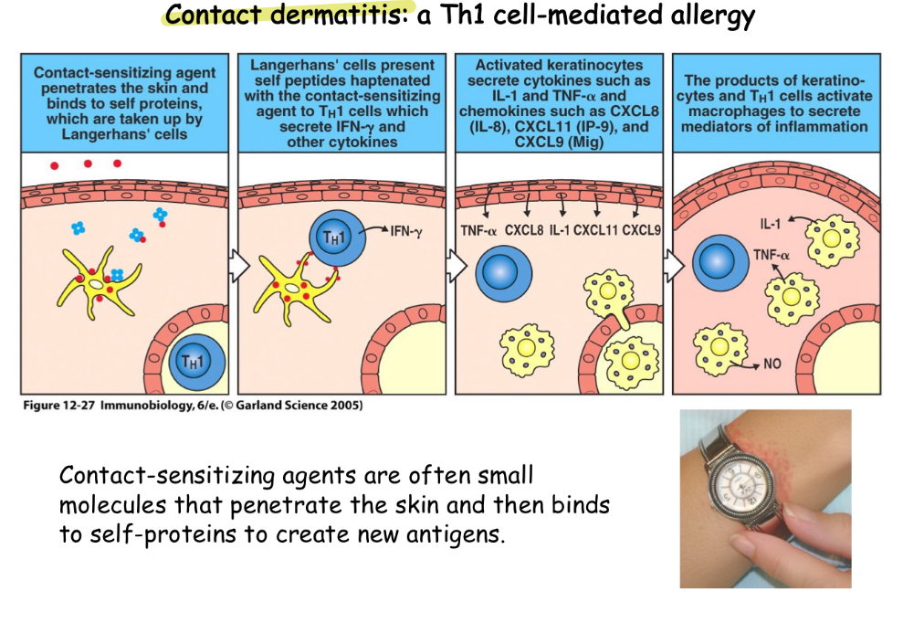<p>Often small molecules that penetrate skin and binds to Self-proteins to create new antigens</p>