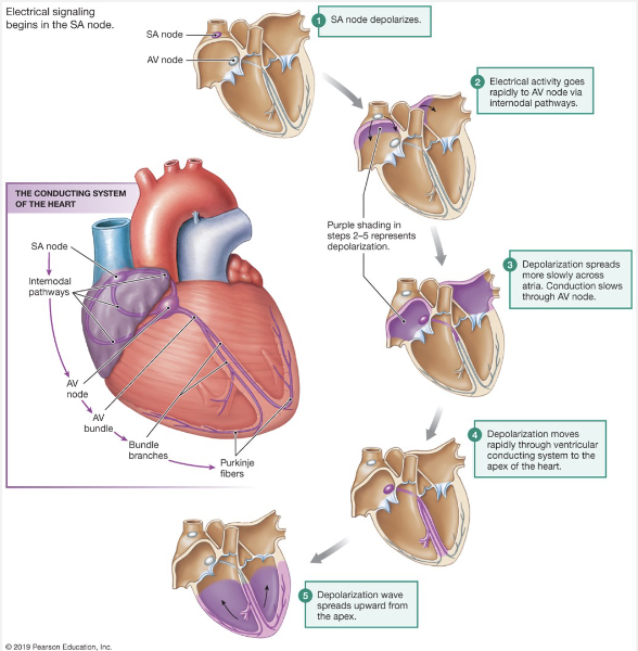 <ul><li><p>Due to autorhymic cells</p></li><li><p>Permeability of membrane changes, causing depolarization</p></li><li><p>Modified by autonomic division</p></li><li><p>AP spreads through heart via gap junctions</p></li><li><p>SA (sinoatrial node) → set of pacemaker cells</p></li><li><p>internodal pathways → used to send depolarized signal to atria </p></li></ul><p>AV node (atrioventricular) delay → set of pacemaker cells, slower rate SA</p><ul><li><p>gives time for atria to top off the ventricle, pushing out the rest of the blood</p></li><li><p>AV bundle → splits into left and right bundle branches. some pacemaker cells have slower rate</p></li><li><p>split into conduction myofibers</p></li></ul><p>AV node follows SA node</p><ul><li><p>AV node has its own rhythm, acting as a backup. If atria doesn’t contract, it’s inconvenient, if ventricle doesn’t contract, you die. </p></li></ul><p></p>