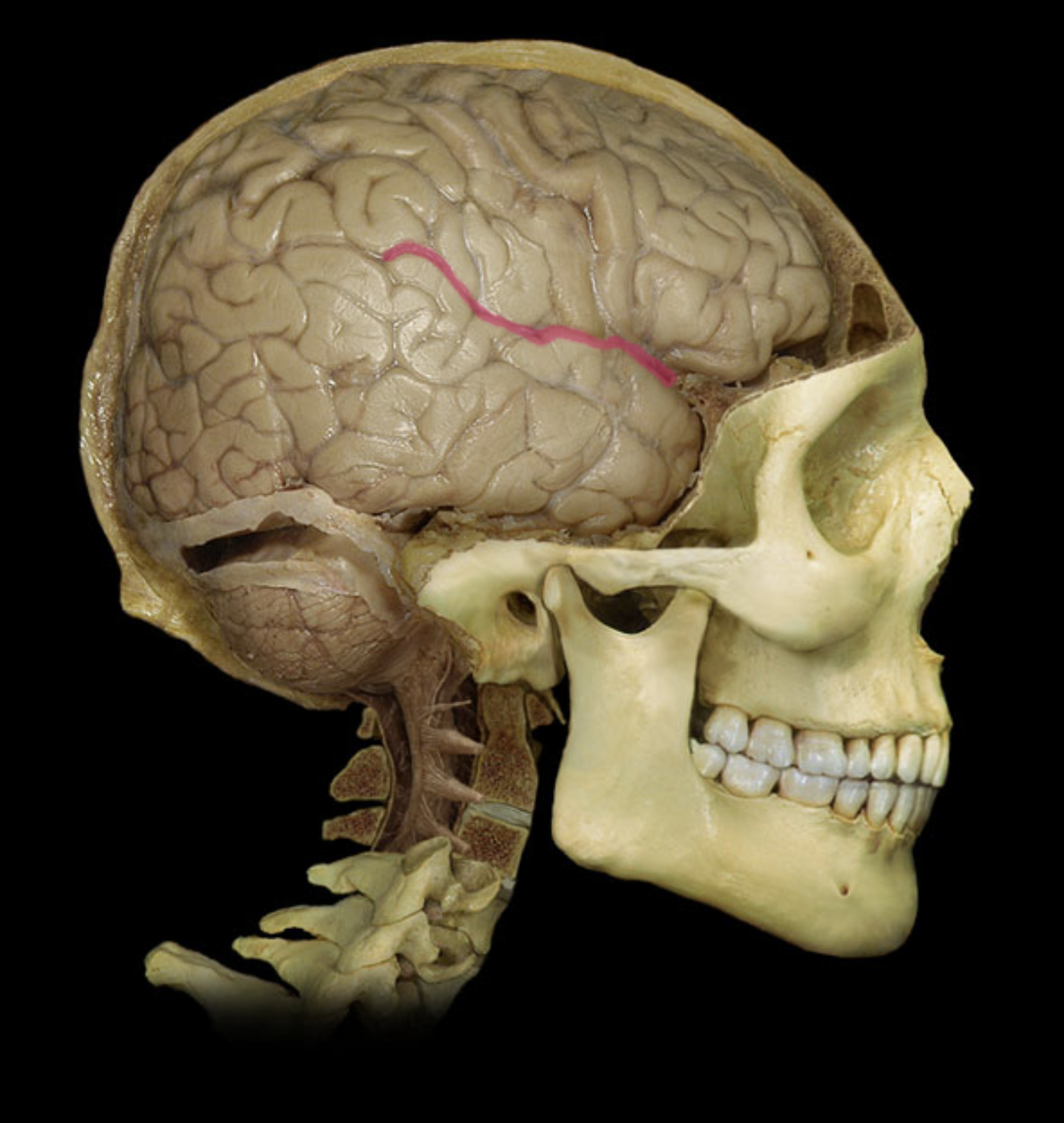 <p>Divides the frontal and parietal from the temporal </p>
