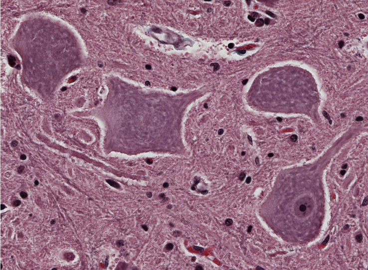 <p><span style="font-family: "Calibri Light";">There are four large motor neurons in this image. Why does only one of them have a visible nucleus? Is there something wrong with them?</span></p>