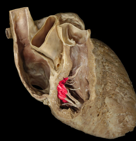 term image
