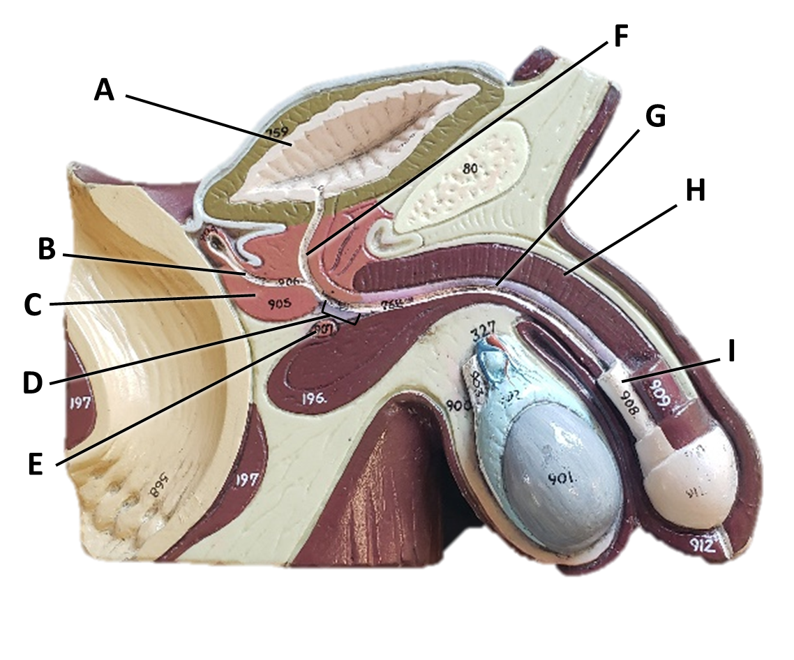 <p><span>Identify the structure/organ labeled with the letter G.</span></p>