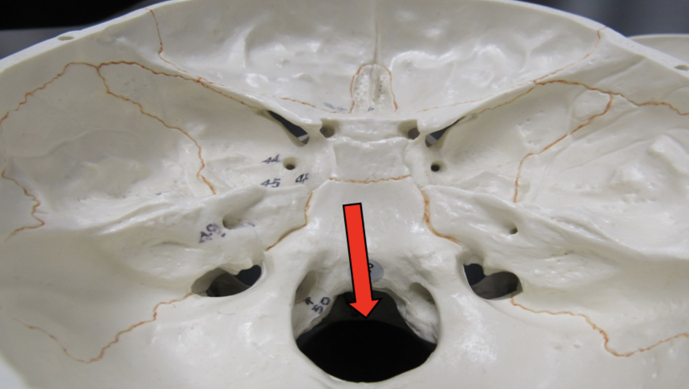 <p><span><strong>Identify the bone marking indicated by the pointer.</strong></span></p>