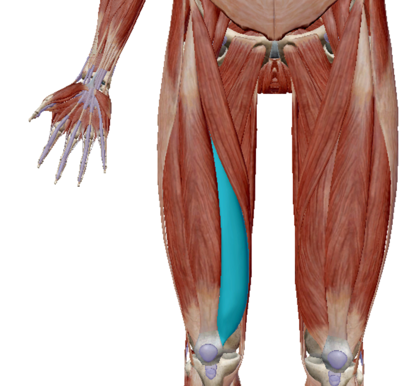 <p>Identify the highlighted muscle. </p>