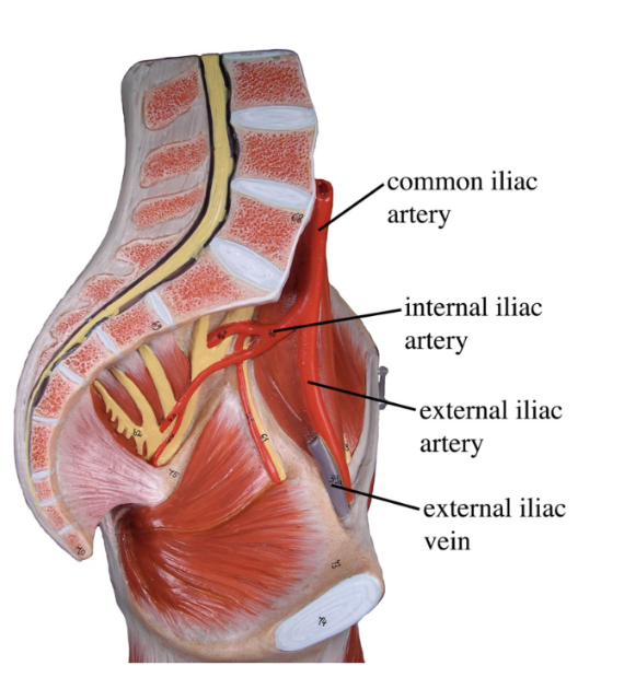<ol><li><p>Common iliac artery</p></li><li><p>Internal iliac artery</p></li><li><p>External iliac artery</p></li><li><p>External iliac vein</p></li></ol><p></p>