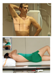 <p>the specific oblique positions in which the left or right posterior aspect of the body is the closest to the IR</p>