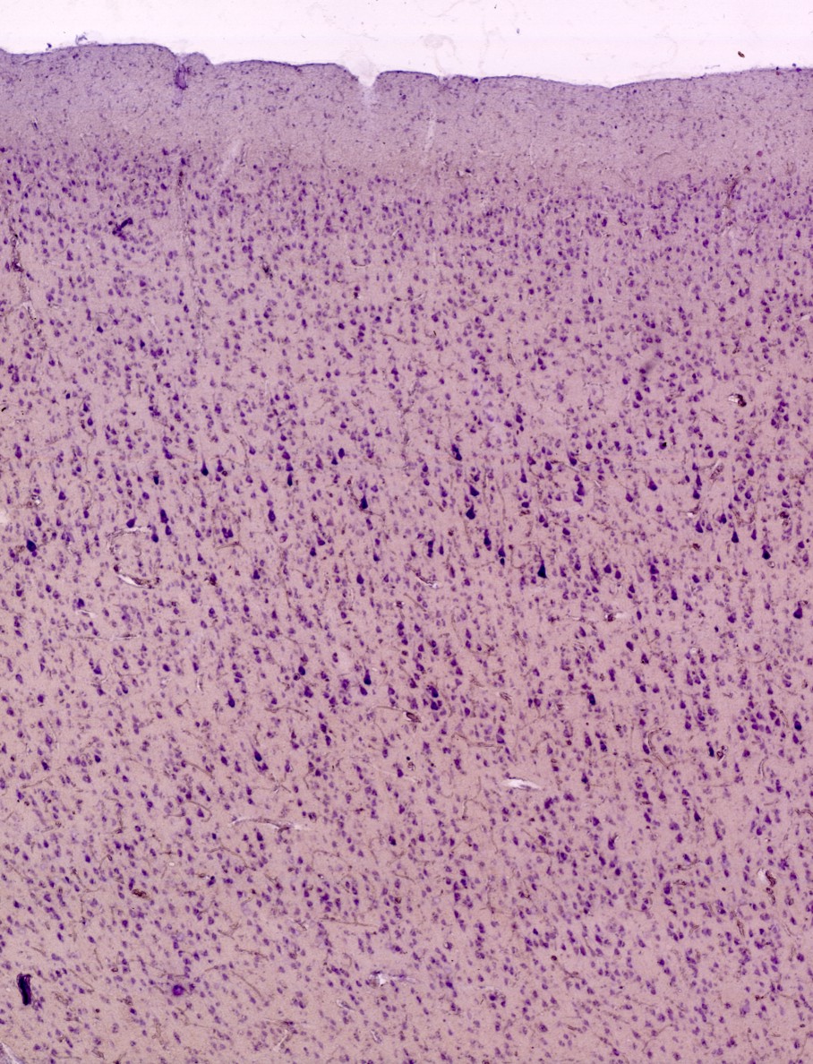 <p>Identifica la plaquita</p>